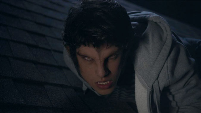 Teen Wolf (2011) Saison 1 épisode 2